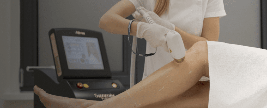 laser-hair-removal-in-karachi