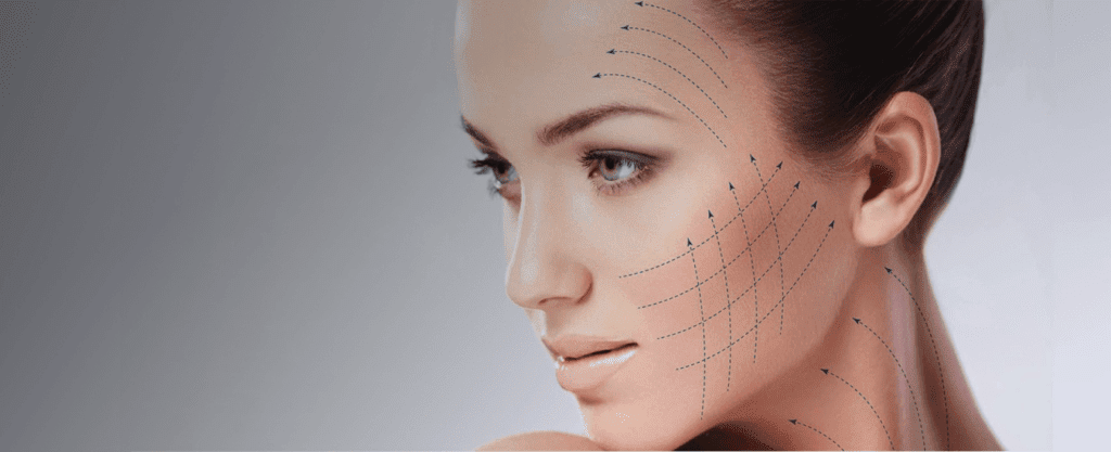 A woman with arrows marking areas for facial lifting and contouring.