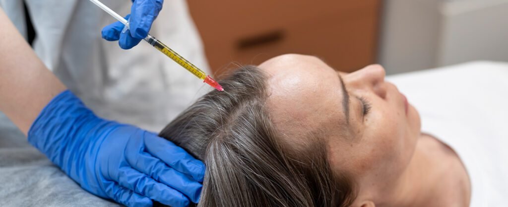A woman receiving a hair restoration injection on her scalp.