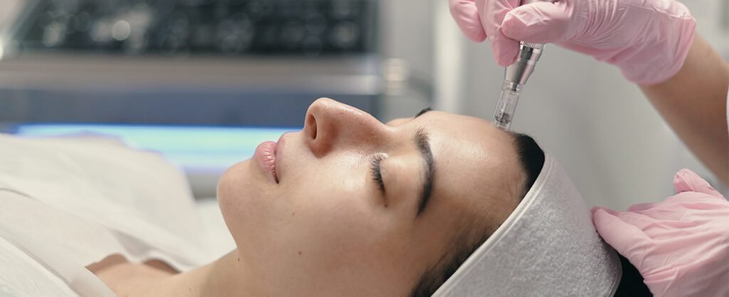 A woman receiving a microneedling treatment on her forehead.