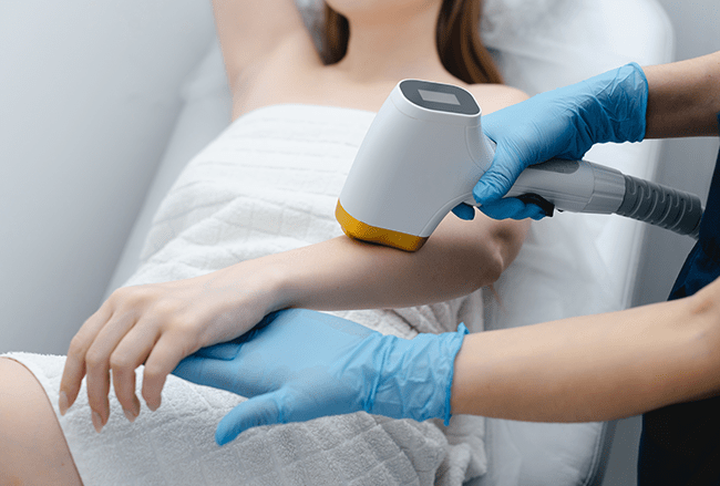 Professional using a laser hair removal device on a woman's arm
