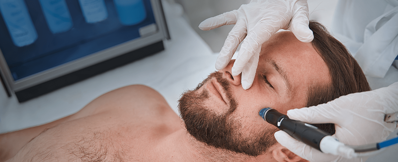 What Are The Most Common Laser Hair Removal Areas For Men?