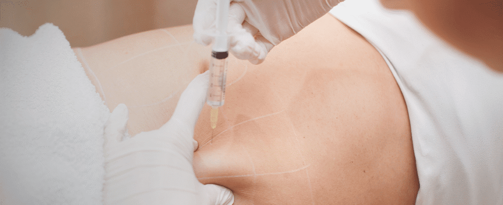 A gloved professional administering a cosmetic injection into the abdomen.