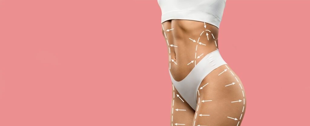 Body contouring treatment areas marked with arrows.