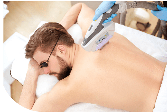 Man receiving laser hair removal treatment on his back in a spa setting, wearing protective eyewear while a technician operates the laser device.