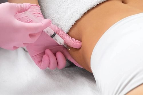 Body sculpting injection being administered to the abdomen.