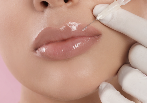 How to Find the Best Lip Filler for Your Unique Look