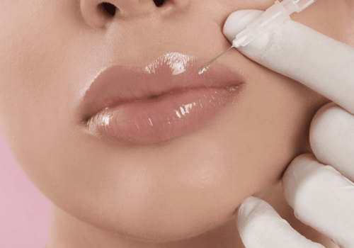 Specialist administering lip filler injection.