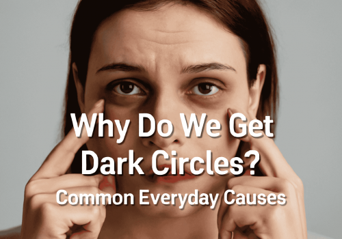 A woman pointing to dark circles under her eyes with text overlay "Why Do We Get Dark Circles? Common Everyday Causes".
