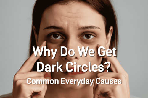 A woman pointing to dark circles under her eyes with text overlay "Why Do We Get Dark Circles? Common Everyday Causes".