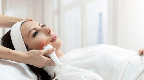 Radiofrequency facial treatment being performed on a woman’s cheek.