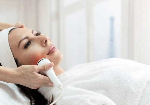 Radiofrequency facial treatment being performed on a woman’s cheek.