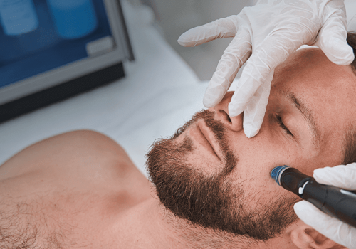 A specialist in white gloves uses a handheld skin therapy device on a man's cheek.