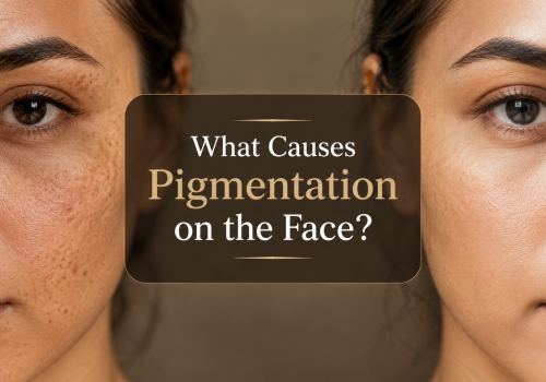 Close-up of two female faces highlighting skin pigmentation differences, with text overlay discussing causes of facial pigmentation. The left side shows darker spots and uneven skin tone, while the right side features clearer, smoother skin. Ideal for articles on skincare and pigmentation issues.