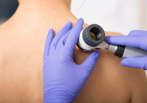 Dermatologist using a dermatoscope to examine a patient's skin.