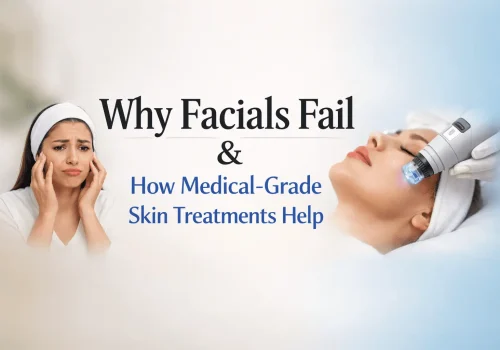 A promotional graphic titled "Why Facials Fail & How Medical-Grade Skin Treatments Help." The left side features a woman looking distressed while touching her face, representing the failure of standard facials. The right side shows a woman lying down receiving an advanced clinical skin treatment using a blue-light technology handpiece, illustrating the effectiveness of medical-grade skincare solutions.