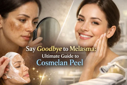 A composite image showing a woman with melasma (dark patches on her skin) looking in a mirror, another woman having a peel-off mask applied, and a third woman smiling with clear skin. The central text says, "Say Goodbye to Melasma: Ultimate Guide to Cosmelan Peel.