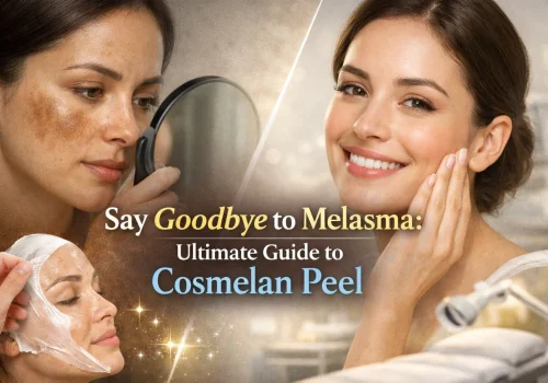 A composite image showing a woman with melasma (dark patches on her skin) looking in a mirror, another woman having a peel-off mask applied, and a third woman smiling with clear skin. The central text says, "Say Goodbye to Melasma: Ultimate Guide to Cosmelan Peel.