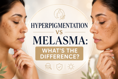 Close-up image of a woman comparing hyperpigmentation and melasma on her skin. The graphic highlights the differences between these two skin conditions, featuring text that reads "Hyperpigmentation vs Melasma: What's the Difference?" The background is softly blurred, emphasizing the subject's facial features and skin concerns.
