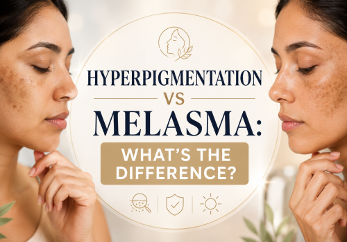 Close-up image of a woman comparing hyperpigmentation and melasma on her skin. The graphic highlights the differences between these two skin conditions, featuring text that reads "Hyperpigmentation vs Melasma: What's the Difference?" The background is softly blurred, emphasizing the subject's facial features and skin concerns.