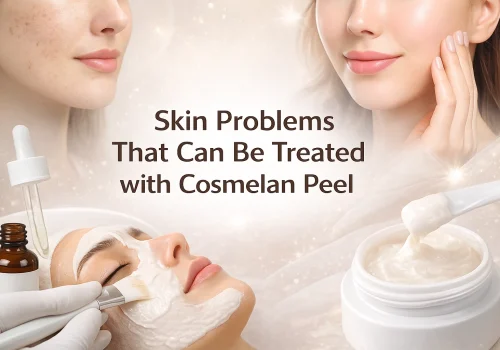 A composite image showcasing the Cosmelan treatment. It features a patient receiving a facial peel application, a jar of the treatment cream, and a "before and after" comparison highlighting the transition from skin with blemishes to a clear, glowing complexion.