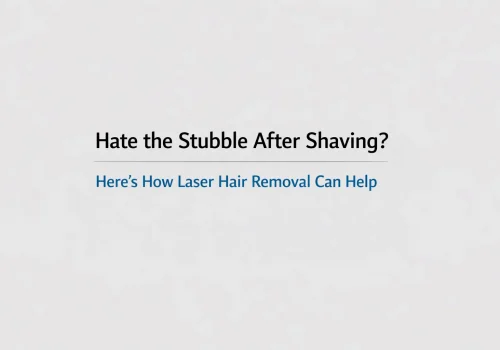Hate the Stubble After Shaving? Here’s How Laser Hair Removal Can Help